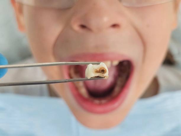 Best Emergency Denture Repair in Bowleys Quarters, MD